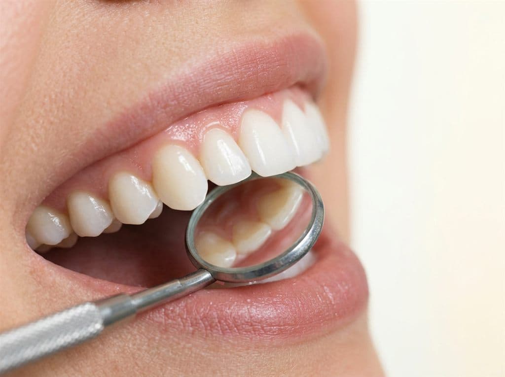 Revisión con espejo dental de una sonrisa antes de un blanqueamiento en Chantada