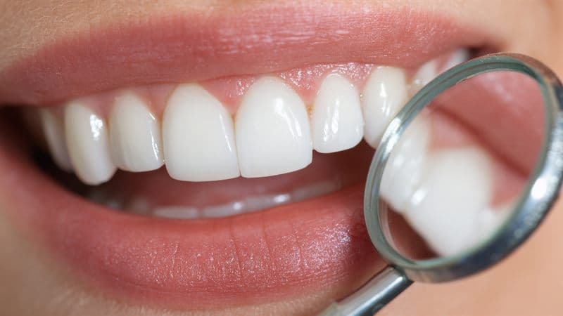 Sonrisa con dientes blancos tras un blanqueamiento dental en Chantada