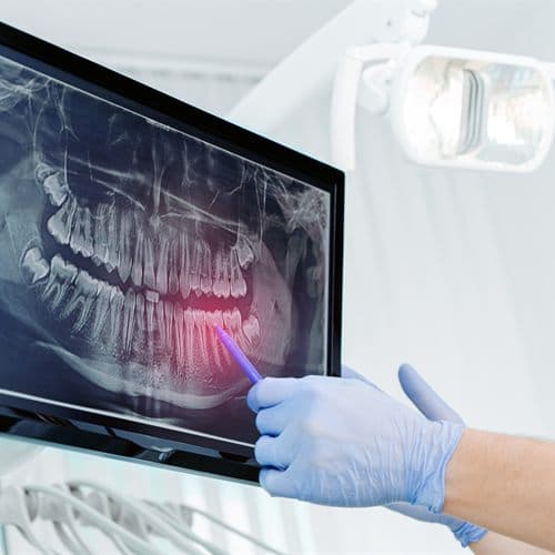 Odontólogo revisando una radiografía panorámica en la clínica dental de Chantada