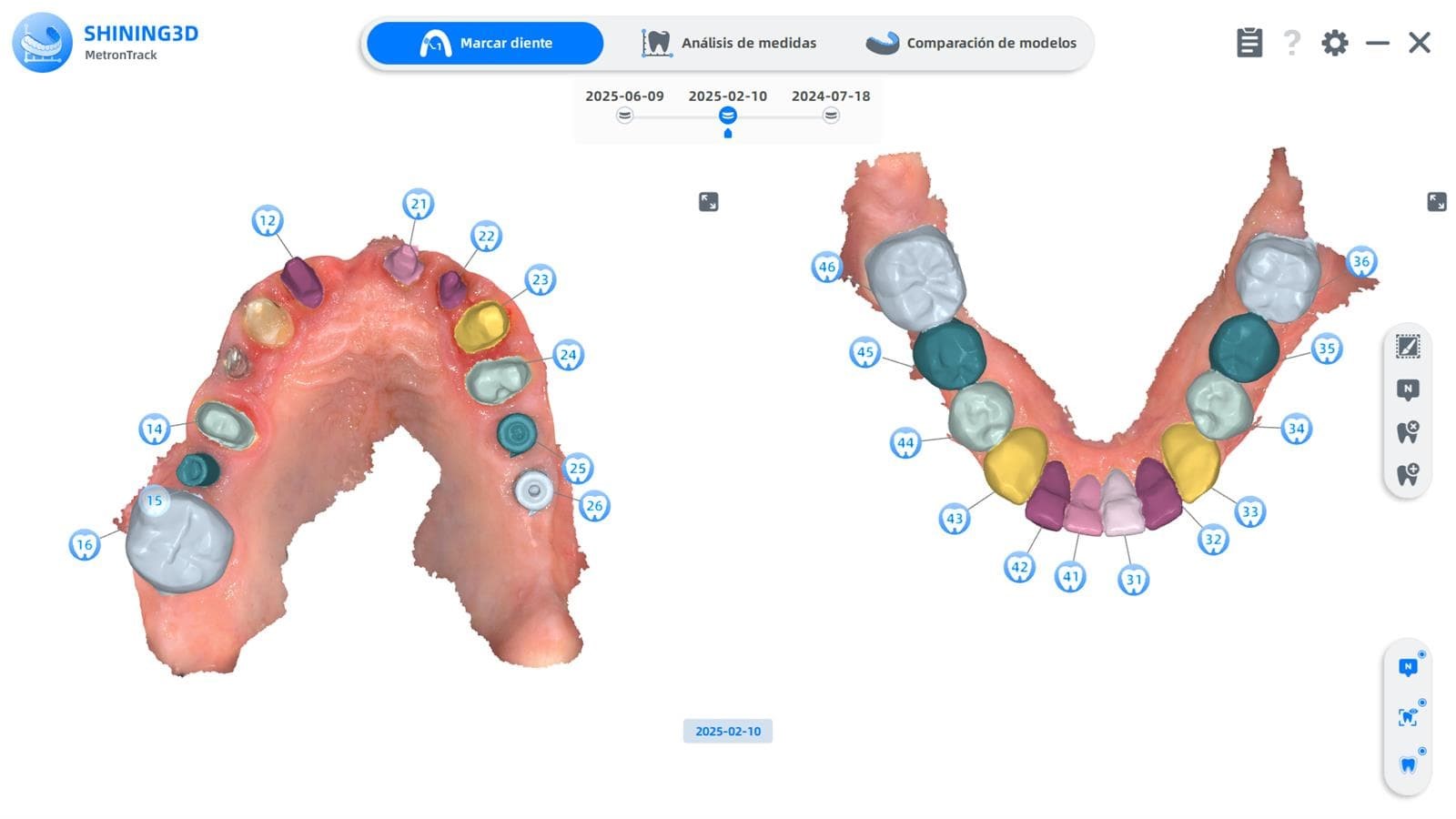 Ya contamos con el Escáner intraoral AORALSCAN 3 - Imagen 2