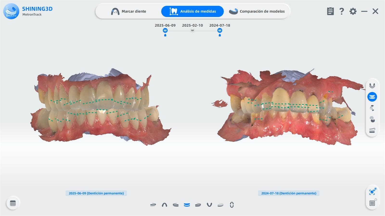 Ya contamos con el Escáner intraoral AORALSCAN 3 - Imagen 3